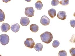 ab2051 at 10µg/ml staining ADAM17 in Hela cells by ICC/IF