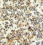 Immunohistochemical analysis of Formalin-fixed, Paraffin-embedded Human lymph tissue labelling CD82 with ab135779 at 1/50 dilution followed by peroxidase-conjugated secondary antibody and DAB staining.