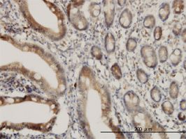 ADAM17 antibody (ab57484) used in immunohistochemistry at 3ug/ml on formalin fixed and paraffin embedded human small Intestine.