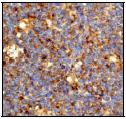 ab53004, at a 1/100 dilution, staining Human CD86 in Tonsil, using Immunohistochemistry, Paraffin embedded tissue.ab53004, at a 1/100 dilution, staining Human CD86 in Tonsil, using Immunohistochemistry, Paraffin embedded tissue.