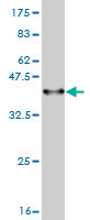 Western blot against tagged recombinant protein immunogen using ab57484 ADAM17 antibody at 1ug/ml. 