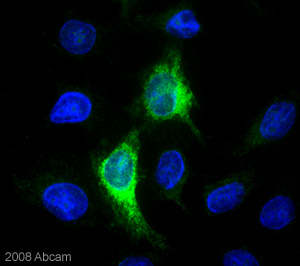 ab57484 was used to detect mouse ADAM17 overexpressed in Hela cells. The transfected cells were incubated with ab57484 (10 µg/ml ) for 1 hour at  22°C. For further details please refer to the Abreview.