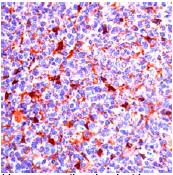 Ab27566, prediluted, staining CD9 in formalin fixed, paraffin embedded human tonsil tissue sections by Immunohistochemistry.