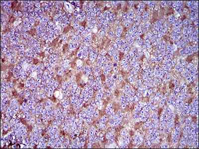Immunohistochemical analysis of paraffin-embedded Human cerebellum tissue labeling CD90 / Thy1 with ab181469 at 1/200 dilution with DAB staining.