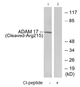 All lanes : Anti-ADAM17 antibody (ab75181) at 1/500 dilutionLane 1 : extracts from rat liver cellsLane 2 : extracts from rat liver cells with immunising peptide at 10 µgLysates/proteins at 30 µg per lane.