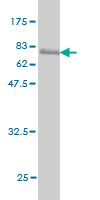 Western blot against tagged recombinant protein immunogen using ab56653 CD96 antibody at 1ug/ml.
