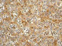 ab108368 at 1/250 dilution staining CD97 in Human spleen by Immunohistochemistry, Paraffin-embedded tissue.
