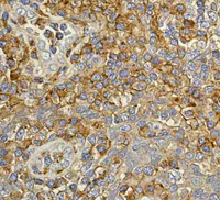 ab108368 at 1/250 dilution staining CD97 in Human colonic tonsil by Immunohistochemistry, Paraffin-embedded tissue.