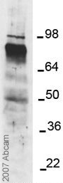 Anti-ADAM17 antibody - Activation site (ab39163) at 1/4000 dilution + MDA-MB231 lysateSecondaryDonkey anti-Rabbit at 1/10000 dilution
