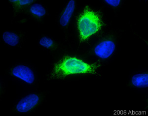 ab39162 was used to detect mouse ADAM17 transiently overexpressed in Hela cells. Ab39162 was incubated with the cells at 10 µg/ml for 1 hour at 22°C. For further details please refer to the Abreview.