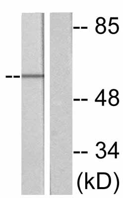 All lanes : Anti-Cdc25A (phospho S75) antibody (ab47279) at 1/500 dilutionLane 1 : Extracts from A2780 cells. UV + no blocking peptide. Lane 2 : Extracts from A2780 cells. Without UV + without blocking peptide.