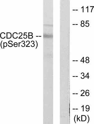 All lanes : Anti-Cdc25B (phospho S323) antibody (ab53103) at 1/300 dilutionLane 1 : NIH/3T3 cell extract treated with PMA (125ng/ml, 30 mins)Lane 2 : NIH/3T3 cell extract treated with PMA (125ng/ml, 30 mins) and the immunogenic phosphopeptide.