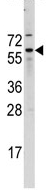 Anti-Cdc25B antibody (ab63220) at 1/60 dilution + A2058 cell line lysate at 35 µg