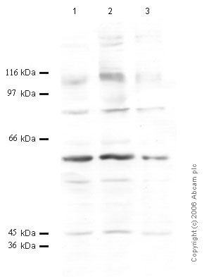 All lanes : Anti-ADAM2 antibody (ab50646) at 1/100 dilutionLane 1 : Tissue lysate prepared from mouse testicle at 15 µlLane 2 : Tissue lysate prepared from mouse testicle at 10 µlLane 3 : Tissue lysate prepared from mouse testicle at 5 µl