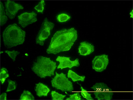 Cdc37 antibody (ab56958) used in immunofluorescence at 10ug/ml on HeLa cells.