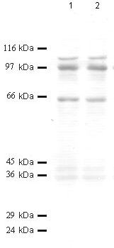 All lanes : Anti-ADAM20 antibody (ab40132) at 1/1000 dilutionLane 1 : Tissue lysate prepared from mouse testis at 20 µlLane 2 : Tissue lysate prepared from mouse testis at 15 µl