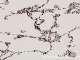 Cdc4 / Fbw7 / hSel 10 antibody (ab55036) used in immunohistochemistry at 3ug/ml on formalin fixed and paraffin embedded human lung.