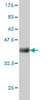 Western blot against tagged recombinant protein immunogen using ab56782 CDC42 Binding Protein Kinase Beta antibody at 1ug/ml.