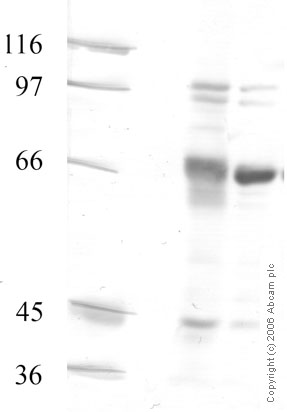 All lanes : Anti-ADAM20 antibody - Catalytic domain (ab28295) at 1/1000 dilutionLane 1 : Mouse Tetis LysateLane 2 : Mouse Epididymis LysateLysates/proteins at 20 µl per lane.