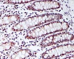 ab126762, at 1/100 dilution, staining CDC45L in paraffin-embedded Human colon tissue by Immunohistochemistry.