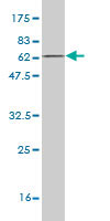 Western blot against tagged recombinant protein immunogen using ab57795 CDCA3 antibody at 1ug/ml.