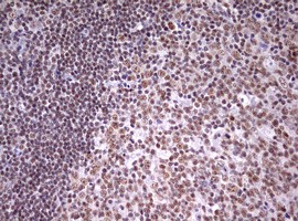 Immunohistochemical analysis of paraffin embedded Human tonsil tissue labeling CDCA7L with ab180480 at 1/250 dilution.