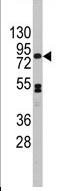 Anti-CDH12 antibody - Aminoterminal end (ab71055) at 1/60 dilution + Jurkat cell line lysate at 35 µg