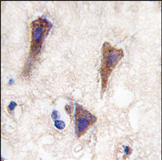 1/10 ab71055 staining CDH12 in formalin fixed, paraffin embedded human brain tissue (peroxidase conjugated secondary antibody, DAB staining).