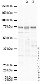 All lanes : Anti-ADAM23 antibody - Cytoplasmic domain (ab28302) at 1 µg/mlLane 1 : Brain (Human) Tissue Lysate - adult normal tissue (ab29466)Lane 2 : Rat Cortex Tissue Lysate Lane 3 : Brain: amygdala (Human) Membrane Lysate - Alzheimer (ab30118)Lysates/proteins at 10 µg per lane.SecondaryGoat Anti-Rabbit IgG H&L (HRP) preadsorbed (ab97080) at 1/5000 dilutiondeveloped using the ECL techniquePerformed under reducing conditions.