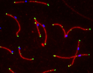 Synaptonemal complexes (red) from human spermatocytes at the pachytene stage showing CDK2 foci (green) and the  kinetochore region (blue).This picture was kindly supplied as part of the review submitted by Maria Oliver-Bonet.