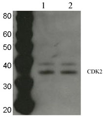 All lanes : Anti-Cdk2 antibody (ab7954) at 1/200 dilutionLane 1 : Whole cell lysate prepared from rat primary cortical neurons (untreated)Lane 2 : Whole cell lysate prepared from rat primary cortical neurons (treated with drug)Lysates/proteins at 20 µg per lane.SecondaryHRP conjugated goat polyclonal to rabbit Ig at 1/10000 dilutionPerformed under non-reducing conditions.