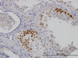 Cdk3 antibody (ab54514) used in immunohistochemistry at 3ug/ml on formalin fixed and paraffin embedded human testis.