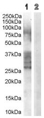 All lanes : Anti-ADAM33 antibody (ab36172) at 0.3 µg/mlLane 1 : Human Prostate lysate (35µg protein in RIPA buffer) with no blocking from immunizing peptideLane 2 : Human Prostate lysate (35µg protein in RIPA buffer) with blocking from immunizimg peptide