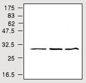 All lanes : Anti-Cdk5 antibody [2G2] (ab28441) at 1/1000 dilutionLane 1 : SH-SY5Y cell lysateLane 2 : SK-N-SH cell lysateLane 3 : Mouse brain tissue
