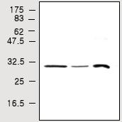 All lanes : Anti-Cdk5 antibody [8A1] (ab28438) at 1/1000 dilutionLane 1 : SH-SY5Y cell lysatesLane 2 : SK-N-SH cell lysatesLane 3 : Mouse brain tissues