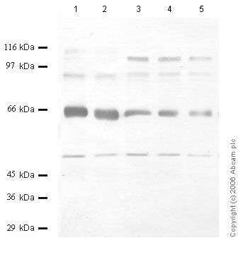 All lanes : Anti-ADAM7 antibody (ab56102) at 1/1000 dilutionLane 1 : Rat Epidid. Tissue Lysate at 10 µlLane 2 : Rat Epidid. Tissue Lysate at 5 µlLane 3 : Rat Testicle Tissue Lysate at 20 µlLane 4 : Rat Testicle Tissue Lysate at 15 µlLane 5 : Rat Testicle Tissue Lysate at 10 µl