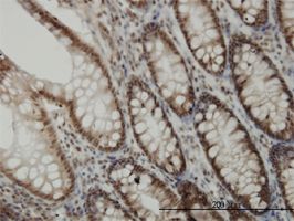 Cdk6 antibody (ab54576) used in immunohistochemistry at 3ug/ml on formalin fixed and paraffin embedded human colon.