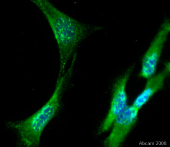 ab39152 used to detect ADAM8 in HeLa cells. For further details please refer to Abreview