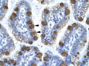 Immunohistochemistry (Formalin/PFA-fixed paraffin-embedded sections) analysis of human intestine tissue labelling Cdk7 with ab894 at 4µg/ml. Staining in epithelial cells of intestinal villus.