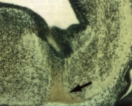 Immunohistochemical staining of mouse tissue using anti-cdk9 (PITALRE) antiserum. The staining shows the location of cdk9 / PITALRE protein in developing mouse tissue. Arrow indicates area of high expression.