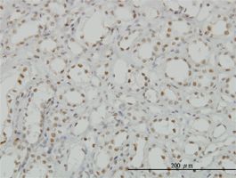 CDKL1 antibody (ab56509) used in immunohistochemistry at 5ug/ml on formalin fixed and paraffin embedded human kidney.