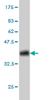 Western blot against tagged recombinant protein immunogen using ab56509 CDKL1 antibody at 1ug/ml.