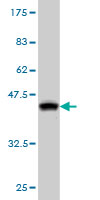 Western blot against tagged recombinant protein immunogen using ab56354 CDKL2 antibody at 1ug/ml.