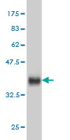 Western blot against tagged recombinant protein immunogen using ab58044 CDKL4 antibody at 1ug/ml.