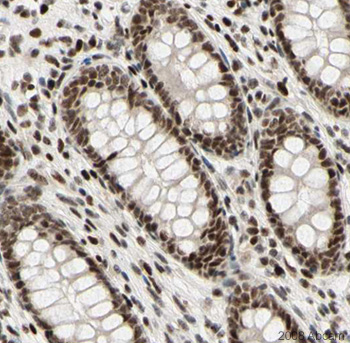 Image courtesy of Human Protein Atlasab22453 staining nuclear CDKL5 in Human appendix. The paraffin embedded human skin tissue was incubated with ab22453 (1/800 dilution) for 30 mins at room temperature. Antigen retrieval was performed by heat induction in citrate buffer pH 6. Ab22453 was tested in a tissue microarray (TMA) containing a wide range of normal and cancer tissues as well as a cell microarray consisting of a range of commonly used, well characterised human cell lines.Further results for this antibody can be found at www.proteinatlas.org