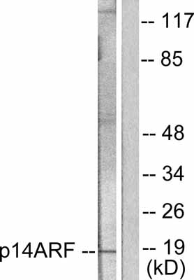 All lanes : Anti-CDKN2A/p14ARF antibody (ab53031) at 1/500 dilutionLane 1 : HeLa cell extractLane 2 : HeLa cell extract with peptide