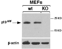 All lanes : Anti-CDKN2A/p19ARF antibody (ab80) at 1 µg/mlLane 1 : 30 ug of mouse embryonic fibroblast total cell extract.Lane 2 : 30 ug of mouse embryonic fibroblast total cell extract.Lane 3 : 30 ug of mouse embryonic fibroblast total cell extract, with the p19ARF gene knocked out as a negative control.Performed under reducing conditions.