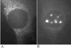 ab80 antibody was tested on NIH 3T3 cells (which have a deletion of the p19ARF gene) as a negative control (-) and NIH 3T3 cells engineered to express HA-tagged p19ARF as a positive control (+). Cells grown on coverslips were fixed with a 1:1 mixture of methanol:acetone at -20C for 10 mins. After drying, rehydrating and blocking, the coverslips were incubated with ab80 at a concentration of 1ug/ml, diluted in PBS for 1 hour at room temperature. The antibody was then visualised using standard anti-rabbit secondary antibodies coupled to Texas Red.