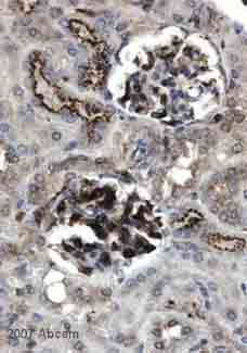 ab80 at 1/300 staining mouse kidney (glomerulus) tissue sections by IHC-P. The tissue was formaldehyde fixed and a heat mediated antigen retrieval step in citrate buffer was performed. The tissue was then blocked and incubated with the antibody for 45 minutes. An HRP conjugated goat anti-rabbit antibody was used as the secondary.See Abreview