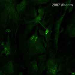 ab80 at 1/300 staining mouse brain cells by ICC/IF.Paraformaldehyde fixation, Triton X-100 permeabilization, followed by blocking with 3% BSA + 2% NGS for 1 hour at 20°C.Incubation with the primary antibody was carried out for 1 hour at 20°C.  The secondary antibody was an Alexa Fluor® conjugated Donkey anti-Rabbit polyclonal, diluted 1/400.See Abreview